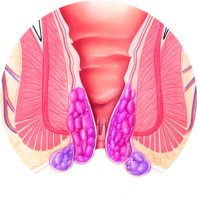 Το Gelarex ανακουφίζει από τα συμπτώματα από την πρώτη χρήση